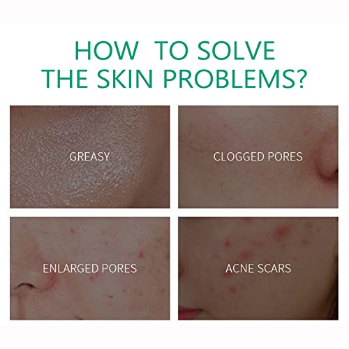 Aichun Beauty Anti-Acne Cream 20g - AC2001