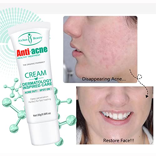 Aichun Beauty Anti-Acne Cream 20g - AC2001