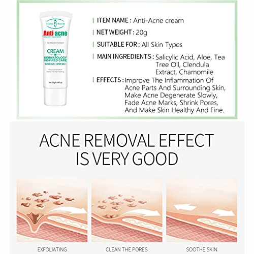 Aichun Beauty Anti-Acne Cream 20g - AC2001