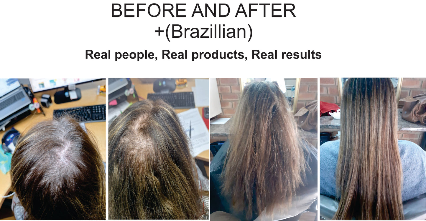 Hair Loss Treatment - COMBO (Real people, Real products, Real results)