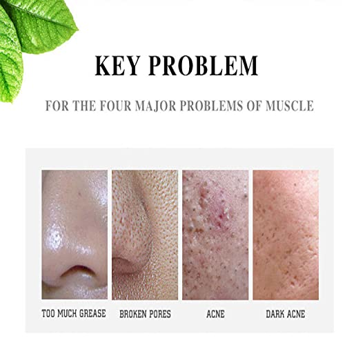 Aichun Beauty, Strong Acene ointment Acene Outispot on, Acene Cream 3 days Acne out, Spot on 30ml