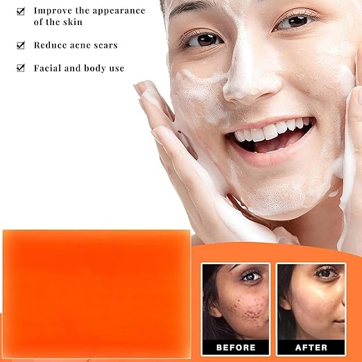 Kojic Acid Soap for Face & Body, Even Skin Tone Smooth Skin, 7 Days Quick - 120g GuanJing Beauty