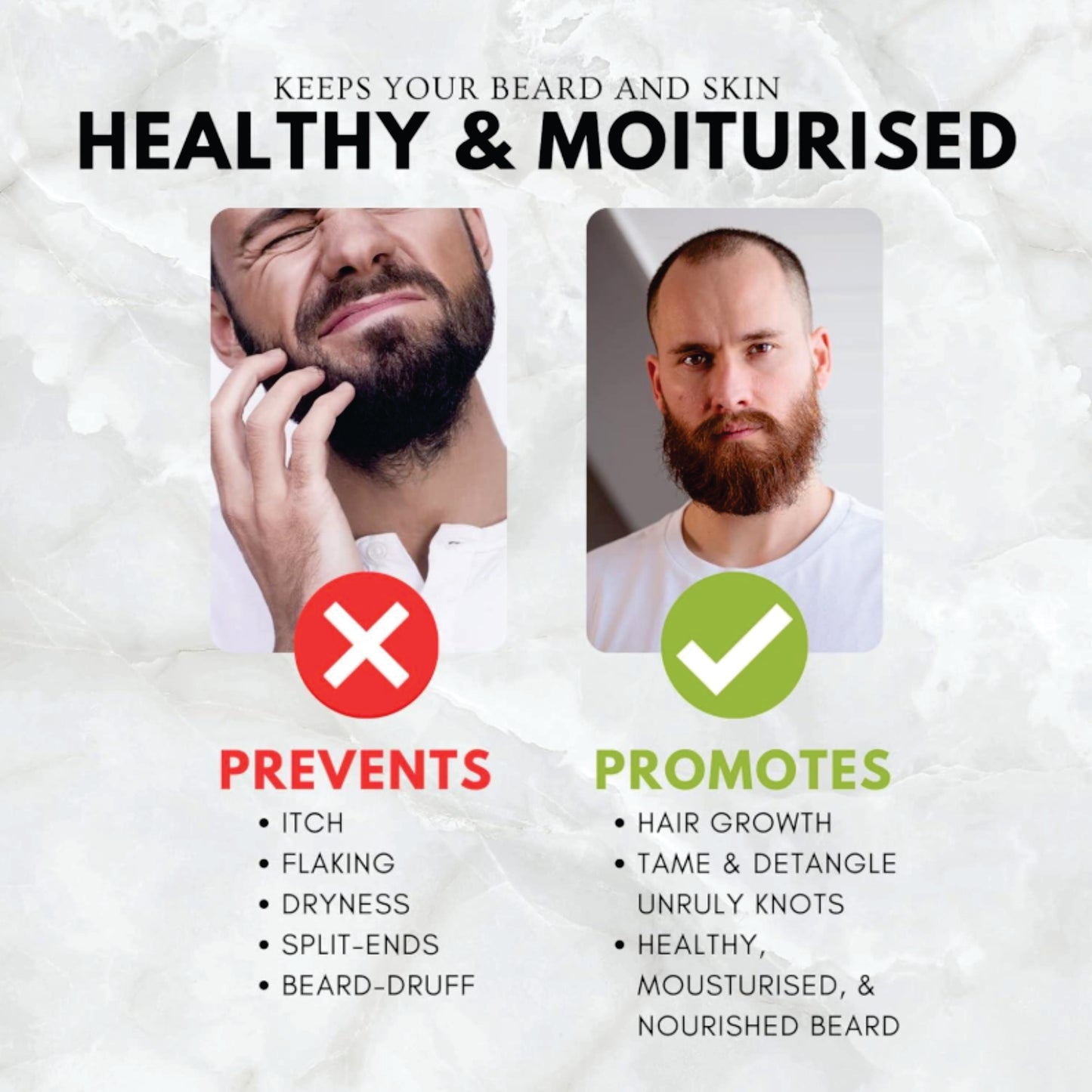 Beard Master Beard Growth Oil – Nourishing & Moisturizing Beard Treatment, 30ml