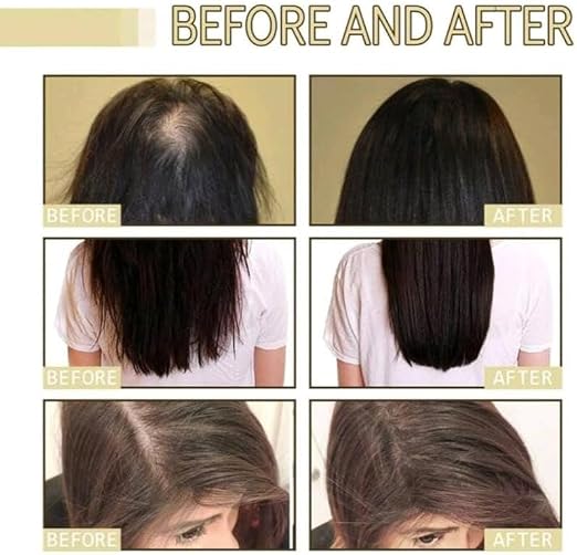 Dr. Comely Batana Oil Shampoo and Conditioner Set, Revitalized Hair Growth and Strength, 500ml Each