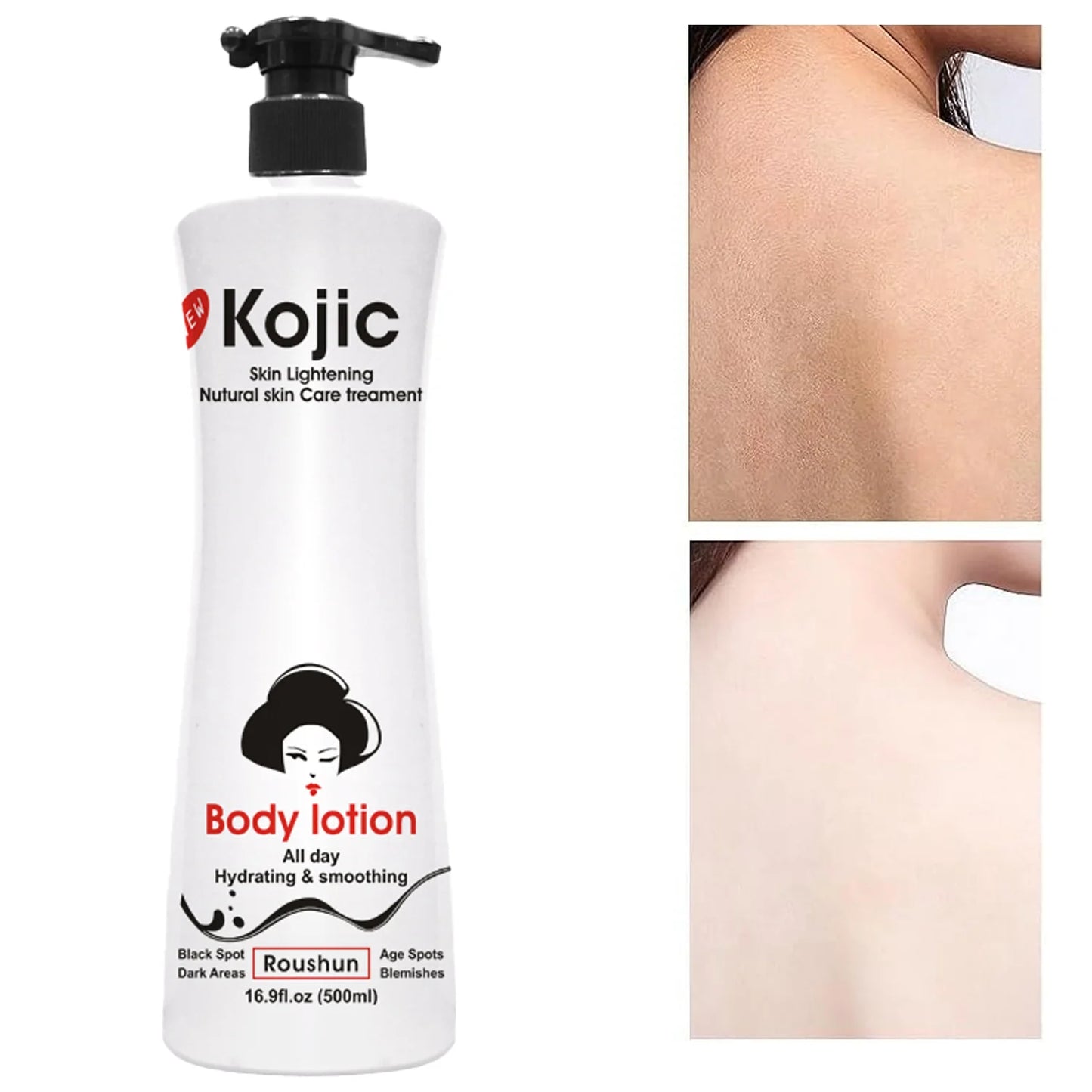 Roushun Kojic Body Lotion 500ml - Moisturizing Whitening Lightening  Hydrating Smoothing Black Spot Age Spots