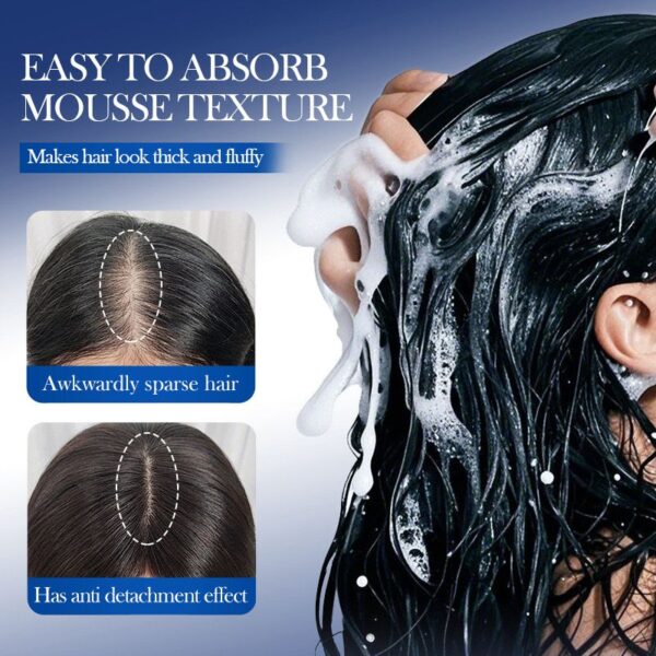 SADOER Minoxidil + Biotin Anti-Hair Loss Foam (5%), 150ml