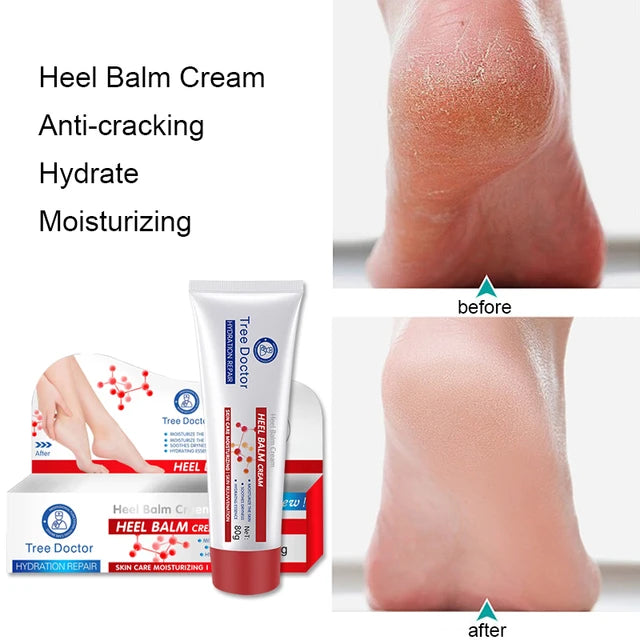 Tree Doctor Heel Balm Cream or Foot Cream 80g